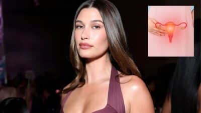 La femme de Justin Bieber souffre de deux kystes ovariens.