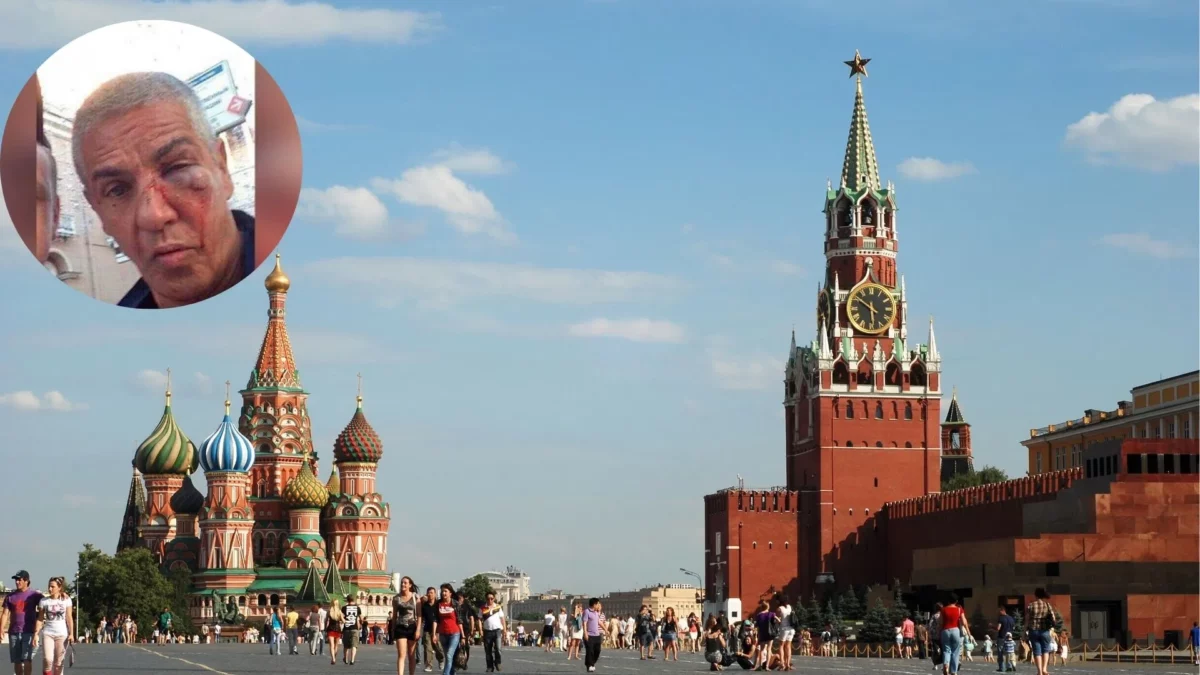 Samy Naceri agressé à Moscou.